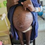 Surinaamse meisje